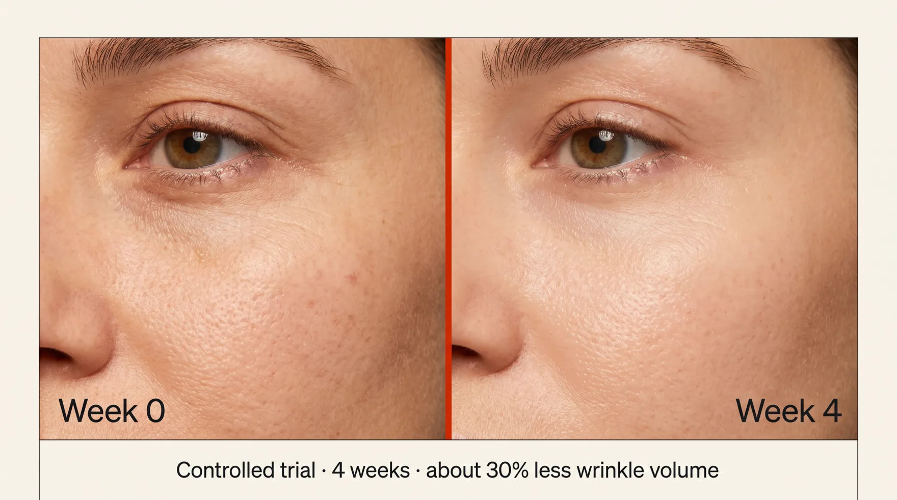 Split close-up of skin around the eye at Week 0 versus Week 4, showing modestly smoother, more even skin. Controlled trial, 4 weeks, about 30 percent less wrinkle volume.